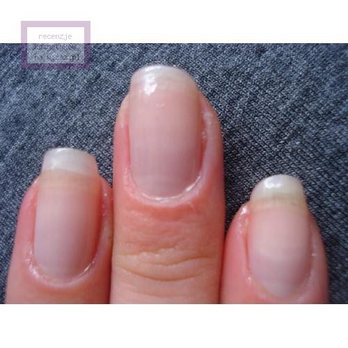 Essie Millionails, Intense Care (Wzmacniająca baza do paznokci (nowa wersja)) - opinie | zdjęcie do recenzji od Y a s m i n e - 1