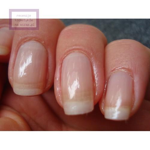 Essie Millionails, Intense Care (Wzmacniająca baza do paznokci (nowa wersja)) - opinie | zdjęcie do recenzji od Y a s m i n e - 2