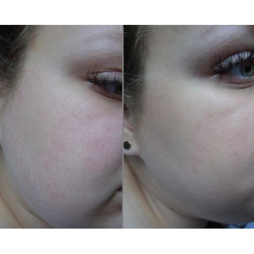 Eveline Cosmetics Lumi Pro Expert, Lekki podkład rozświetlający SPF 10 - opinie | zdjęcie do recenzji od milka6263 - 2