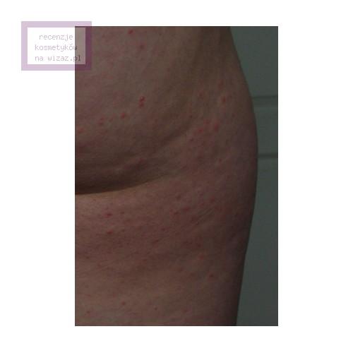 Tołpa Body Pro, Anti Cellulite, Nocny eliminator cellulitu (Drenujący super-koncentrat wyszczuplający na noc) - opinie | zdjęcie do recenzji od night prowler - 1