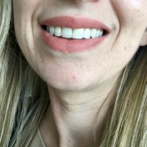 Douglas Collection Kiss Kit by Joanna Krupa (Zestaw do makijażu ust) - opinie | zdjęcie do recenzji od petronellka1987