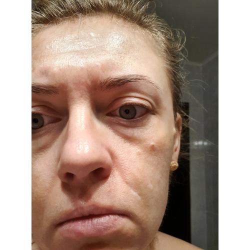 Eveline Cosmetics Facemed +, Enzymatyczny peeling oczyszczający 3 w 1 - opinie | zdjęcie do recenzji od pauli25 - 1