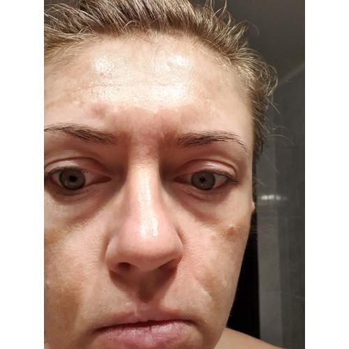 Eveline Cosmetics Facemed +, Enzymatyczny peeling oczyszczający 3 w 1 - opinie | zdjęcie do recenzji od pauli25 - 2
