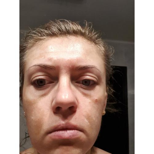 Eveline Cosmetics Facemed +, Enzymatyczny peeling oczyszczający 3 w 1 - opinie | zdjęcie do recenzji od pauli25 - 3