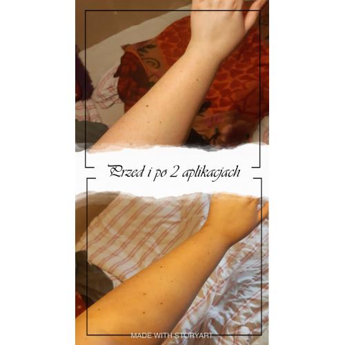 Avon Sun +, Magic Tan, Self - Tan Bronzing Mousse (Samoopalacz w musie z kompleksem ujędrniającym) - opinie | zdjęcie do recenzji od saralaskamua - 1
