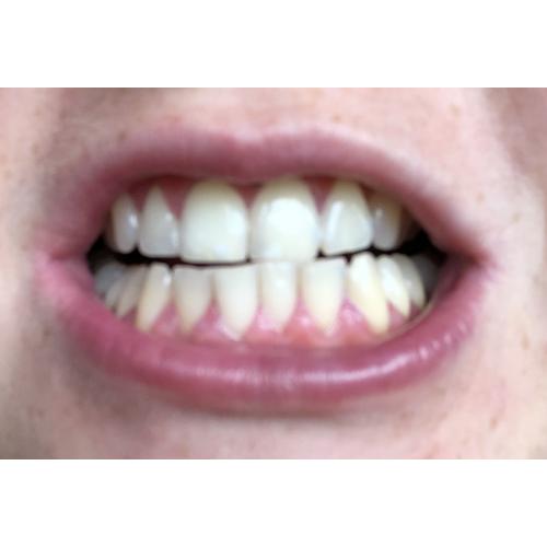 Carter-Wallace Pearl Drops, Instant Natural White Toothpaste (Pasta wybielająca z aktywnym węglem) - opinie | zdjęcie do recenzji od olachojnaa - 1
