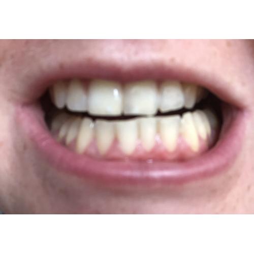 Carter-Wallace Pearl Drops, Instant Natural White Toothpaste (Pasta wybielająca z aktywnym węglem) - opinie | zdjęcie do recenzji od olachojnaa - 2