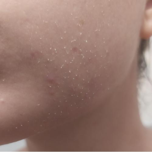 Revuele Face Peeling Gel with Snail Filtrate (peelingujący żel do twarzy ze śluzem ślimaka) - opinie | zdjęcie do recenzji od glodna_pomyslow