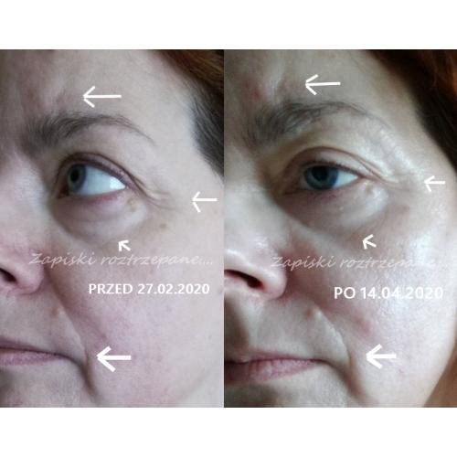 Larens Bio Renew Tissue Face Mask (Maska do twarzy) - opinie | zdjęcie do recenzji od Momo - 4