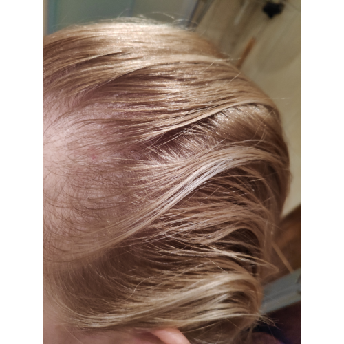 TRESemme Day2, Foaming Dry Shampoo Fresh & Clean (Sychy szampon w piance) - opinie | zdjęcie do recenzji od ravelia - 3
