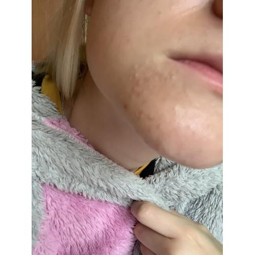 Apis Exfoliating Home Care, Intensywna odnowa skóry w 20 dni - opinie | zdjęcie do recenzji od Imkaro - 4