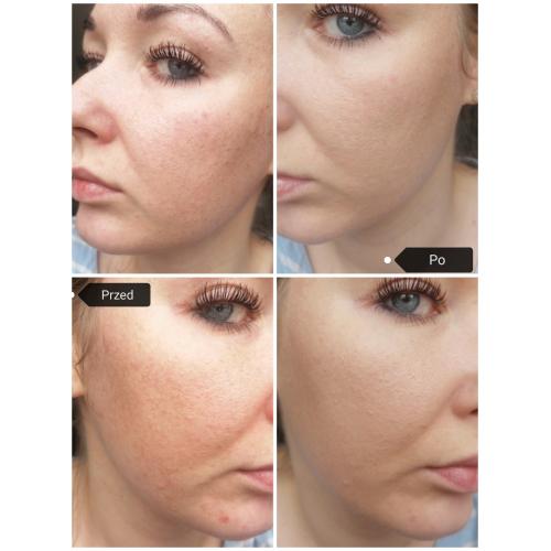 SinSkin Must.Have, True Luminous Foundation SPF 30 (Fluid rozświetlający) - opinie | zdjęcie do recenzji od topxgirl - 2