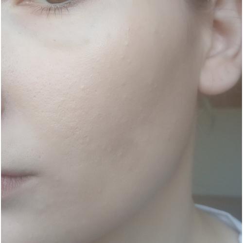 Rival de Loop Invisible Fluid Make-up (Podkład do twarzy) - opinie | zdjęcie do recenzji od wiliamAKAwilhelm - 1
