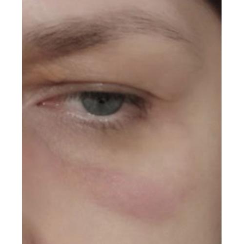 Mel Skin Cosmetics Rozświetlający krem pod oczy z witaminą C - opinie | zdjęcie do recenzji od jedynatakalola