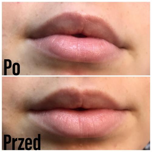 Estee Lauder Pure Color Envy Lip Repair Potion (Emulsja regenerująca do ust) - opinie | zdjęcie do recenzji od Deluther - 3