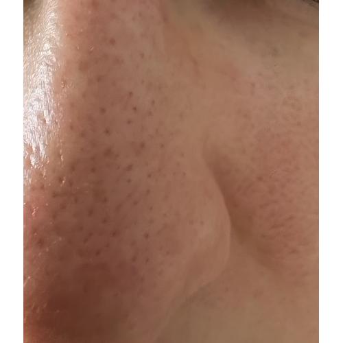 Some by MI Super Matcha, Pore Tightening Serum (Serum zwężające pory z herbatą matcha) - opinie | zdjęcie do recenzji od Pikkumyy345 - 1