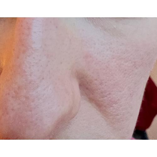 Some by MI Super Matcha, Pore Tightening Serum (Serum zwężające pory z herbatą matcha) - opinie | zdjęcie do recenzji od Pikkumyy345 - 2