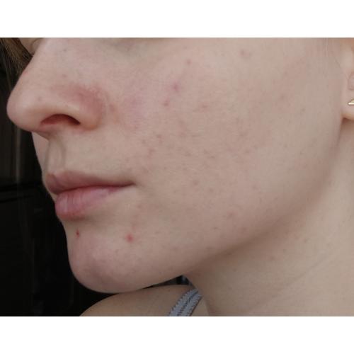 Floslek Sun Care, Krem-żel anti spot SPF 50 - opinie | zdjęcie do recenzji od Adrianna_8
