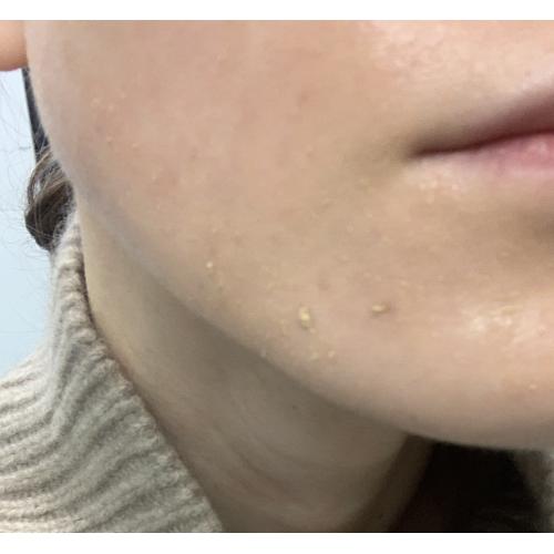 Inglot Pore Free Skin Makeup Base (Baza pod makijaż) - opinie | zdjęcie do recenzji od adulka1993 - 2