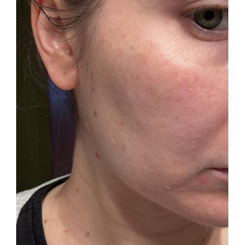 Tołpa My Skin Changer, Light Bodyguard, Krem SPF 50 `Wysoka fotoochrona` - opinie | zdjęcie do recenzji od iza_maz - 1