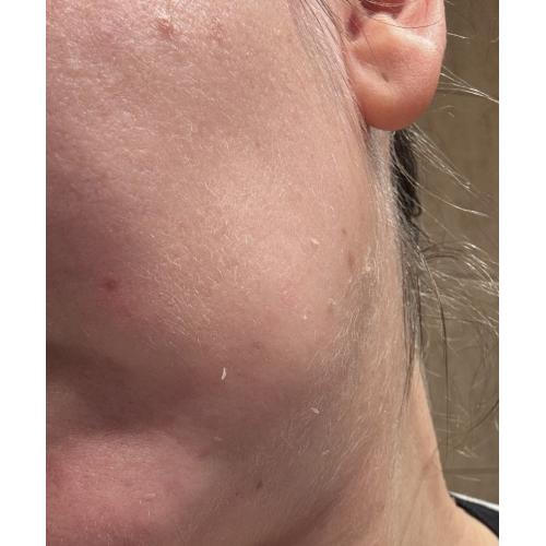 Tołpa My Skin Changer, Light Bodyguard, Krem SPF 50 `Wysoka fotoochrona` - opinie | zdjęcie do recenzji od iza_maz - 2