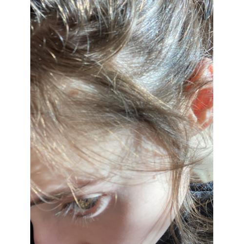 Noyo Pharm Hair, Suplement diety - opinie | zdjęcie do recenzji od 365c6d33586e62bd0eee61bd701133ffc2eddc97_668dc0fcc4e7c - 1