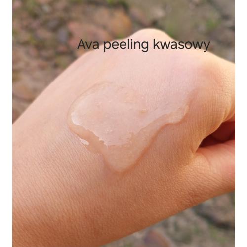 Laboratorium Kosmetyczne AVA Kwas migdałowy 15% (Peeling kwasowy redukujący oznaki starzenia skóry) - opinie | zdjęcie do recenzji od Smerfeta83 - 2
