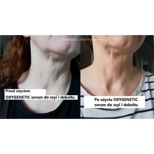Oxygenetic Relift Vitamin A neck and Bust Serum (Liftingujące serum do szyi i dekoltu) - opinie | zdjęcie do recenzji od Momo - 2