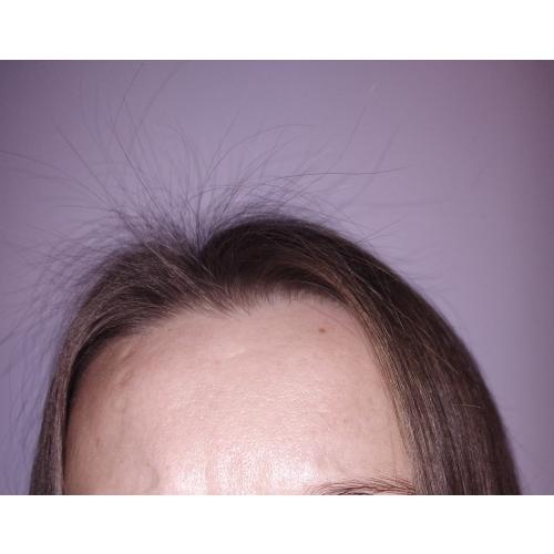 beBIO Baby Hair Complex,  Naturalna wzmacniająca wcierka stymulująca wzrost włosów - opinie | zdjęcie do recenzji od ILikeRead