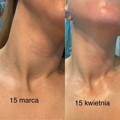 BasicLab Dermocosmetics Esteticus, Korygujący balsam do ciała z 0,2% czystego retinolu - opinie | zdjęcie do recenzji od agacior89