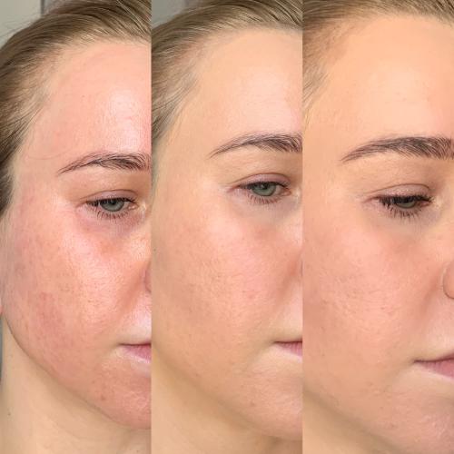Hean CC Cream Vital Skin SPF 40 UVA/UVB (Lekki kryjący podkład) - opinie | zdjęcie do recenzji od agacior89 - 2