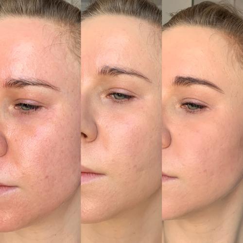 Hean CC Cream Vital Skin SPF 40 UVA/UVB (Lekki kryjący podkład) - opinie | zdjęcie do recenzji od agacior89 - 3