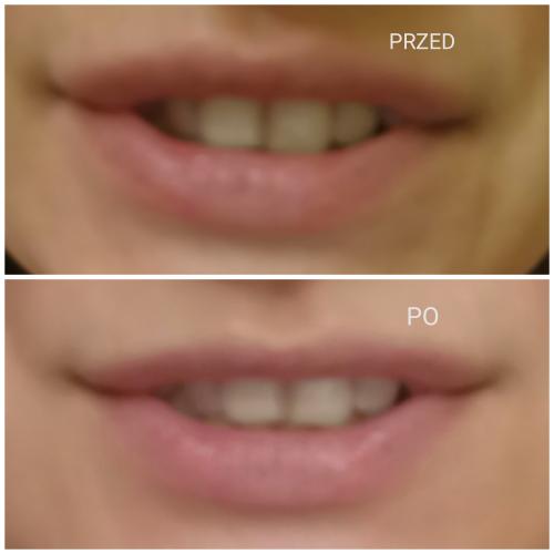 Sensodyne Daily Whitening, Wybielająca pasta do zębów wrażliwych - opinie | zdjęcie do recenzji od antekkk