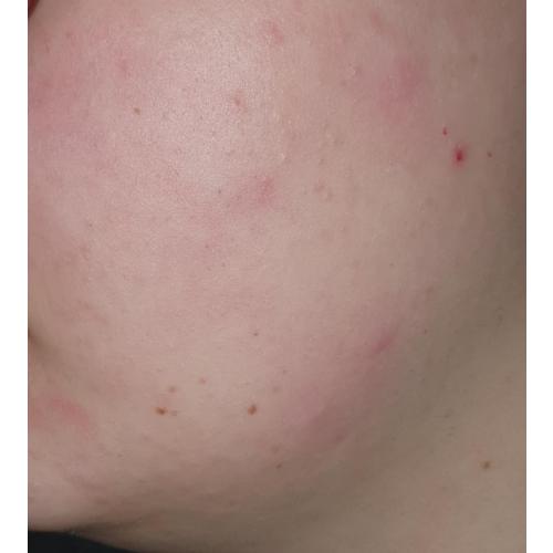 Dr. Althea 345 Relief Cream (Regenerujący krem do twarzy) - opinie | zdjęcie do recenzji od Demka666 - 2