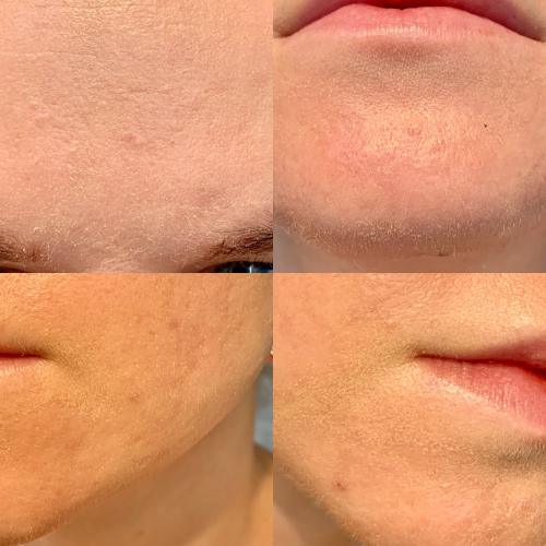 AA Aloes, Nawilżający krem SPF 50 - opinie | zdjęcie do recenzji od agacior89 - 4
