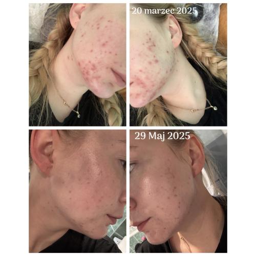 Q+A Niacinamide Balancing Daily Sunscreen SPF50 (Równoważący krem przeciwsłoneczny z niacynamidem) - opinie | zdjęcie do recenzji od Elvisek_k